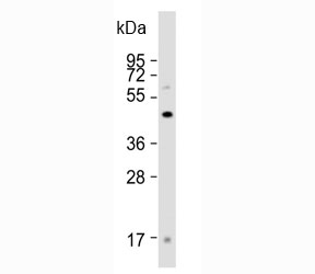 Western blot analysis of FOXG1 antibody and human brain tissue lysate. Predicted molecular weight: 50-52 kDa.