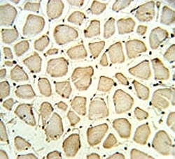 PGP antibody IHC analysis in formalin fixed and paraffin embedded skeletal muscle.