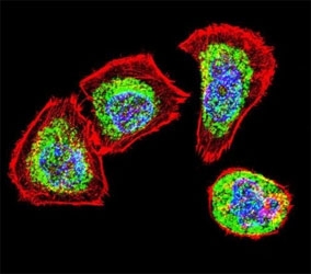 Vimentin Antibody / Neural Cytoskeleton Immunofluorescence Marker Antibody. Immunofluorescence analysis of Vimentin / VIM in human U251 glioblastoma cells demonstrating strong cytoplasmic filamentous staining (green) consistent with neural-associated cytoskeletal network organization. The Vimentin Antibody / Neural Cytoskeleton Immunofluorescence Marker Antibody highlights prominent intermediate filament structures and elongated, invasive cell morphology characteristic of glioblastoma cells, with clear distinction from actin filaments labeled in red. Nuclei are counterstained with DAPI (blue), supporting high-resolution visualization of cytoskeletal architecture and neural tumor cell morphology in confocal imaging.