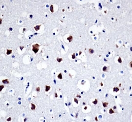 Src antibody immunohistochemistry analysis in formalin fixed and paraffin embedded human brain tissue
