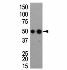 Western blot analysis of HA antibody and tagged recombinant protein bacterial lysate
