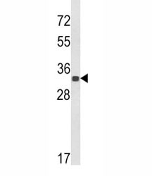 Western blot analysis of His Tag antibody and a His tagged protein.