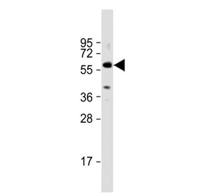 TGFBR1 antibody western blot analysis in human A431 cell lysate. Predicted molecular weight: ~55 kDa.