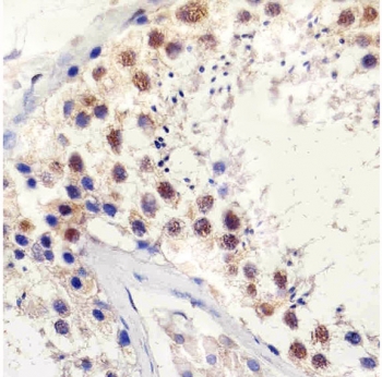 IHC testing of FFPE human testis tissue with TBP antibody at 1:25 dilution. HIER: pH6 citrate buffer.