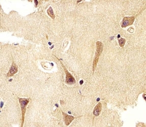 Immunohistochemical analysis of paraffin-embedded human brain using UCHL1 antibody at 1:25 dilution.