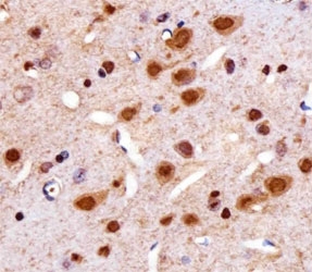 IHC analysis of FFPE rat brain section using Cdk4 antibody at 1:25.