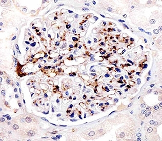 FABP4 Antibody Kidney IHC. Immunohistochemical analysis of paraffin-embedded human kidney using FABP4 antibody at 1:25 dilution.