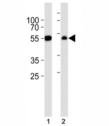 Western blot analysis of lysate from (1) A549 cell line and (2) rat liver tissue lysate using ALDH1A1 antibody diluted at 1:1000.