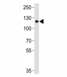 Western blot analysis of lysate from mouse kidney tissue lysate using DDR1 antibody diluted at 1:1000. Predicted molecular weight: 100~125KD.