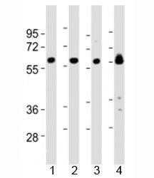 Western blot testing of Lyn antibody at 1:2000 dilution and mouse samples: Lane 1: kidney lysate; 2: heart lysate; 3: ovary lysate; 4: skeletal muscle lysate; Predicted molecular weight 56/58 kDa (isoforms 1/2).