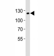 SIRT1 Antibody Mouse F9 Cell WB. Western blot analysis of lysate from mouse F9 cell line using SIRT1 antibody at 1:1000. Predicted molecular weight ~80kDa but is routinely observed at 110~120kDa due to post-translational modification.