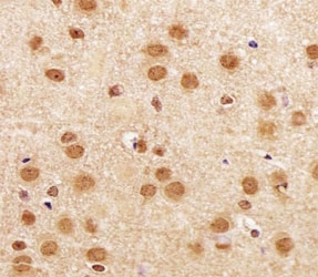 SIRT1 Antibody Mouse Brain IHC. Immunohistochemistry analysis of FFPE mouse brain section using SIRT1 antibody at 1:25.