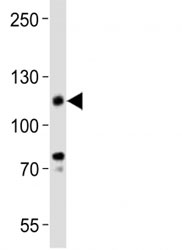 Western blot analysis of lysate from KG-1 cell line using anti-CD34 antibody.  Expected size is 40~110 kDa depending on glycosylation level.
