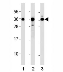 Western blot testing of DKK1 antibody at 1:2000 dilution. Lane 1: A549; 2: Jurkat; 3: NIH3T3 lysate; Predicted molecular weight: 26-40 kDa depending on glycosylation level.