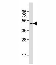 Western blot testing of Smad3 antibody at 1:2000 dilution + rat brain lysate; Observed molecular weight: 48~55 kDa.