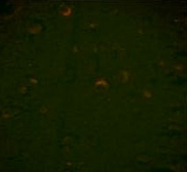 Immunofluorescence analysis of BECN1 antibody with paraffin-embedded human brain tissue; Ab was followed by PE-conjugated goat anti-mouse lgG. PE emits orange fluorescence.