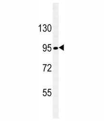 Nephrin antibody western blot analysis in SK-BR-3 lysate. Ab used at 1:100 dilution. Predicted molecular weight ~150 kDa but often observed at a lower size.
