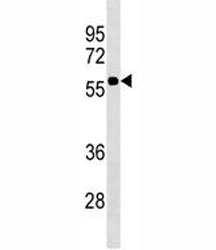 CD1A Antibody for WB. Western blot analysis of CD1A / CD1a protein expression in human Jurkat cell lysate using CD1A Antibody for WB. Lane 1: jurkat cell lysate. A band is detected at approximately 50-55 kDa, consistent with the predicted molecular weight of CD1A / CD1a (37-49 kDa). The upward shift in apparent molecular weight is consistent with glycosylated forms of CD1A, and supports analysis of CD1A isoforms and post-translationally modified variants observed as band shifts in immunoblot experiments.