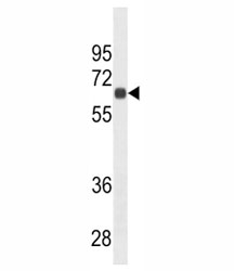 CD138 antibody western blot analysis in HepG2 lysate. Predicted molecular weight: 32-95 kDa depending on glycosylation level.