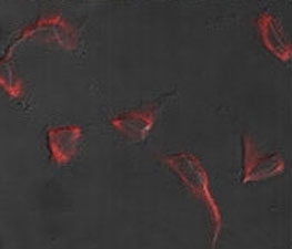 Immunofluorescence analysis of Nestin antibody and HeLa cells. Primary antibody was followed by Alexa-Fluor-546-conjugated donkey anti-rabbit lgG (H+L). Alexa-Fluor-546 emits orange fluorescence.