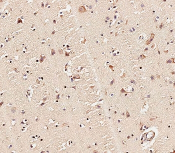 IHC staining of FFPE human brain tissue with MLL2 antibody. HIER: steam section in pH9 EDTA for 20 min and allow to cool prior to staining.
