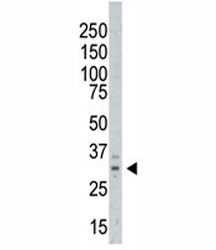 Western blot testing of AURKC antibody and A375 cell lysate. Predicted molecular weight ~ 33 kDa.