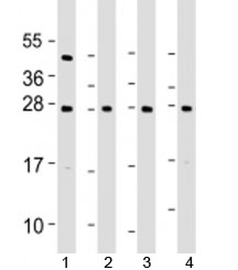 Western blot testing of human 1) 293T/17, 2) A431, 3) HeLa and 4) MCF7 cell lysate with RPL14 antibody at 1:2000. Predicted molecular weight: 23 kDa.