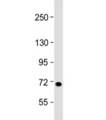 Western blot testing of human 293T/17 cell lysate with L3MBTL4 antibody at 1:2000. Predicted molecular weight: 71 kDa.