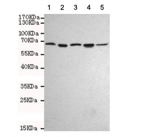 Western blot testing of human 1) HeLa, 2) Ramos, 3) HepG2, 4) MCF7 and 5) Jurkat cell lysates using AIF antibody at 1:1000. Predicted molecular weight ~67 kDa.