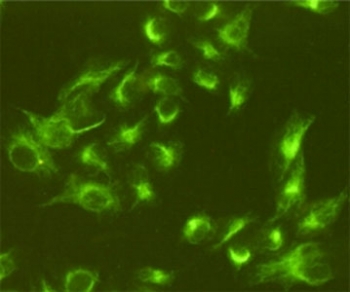 Vimentin Antibody HeLa Cell IF. Immunofluorescence staining of HeLa cells, fixed with 4% Paraformaldehyde, using Vimentin antibody at 1:800.