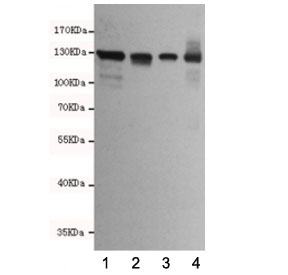 E-cadherin Antibody for WB. Western blot analysis of Cadherin 1 / CDH1 expression in human cell lysates: 1) T47D, 2) HCT116, 3) MDA-MB-468, and 4) Caco-2 using clone 6B10-F4-G10 antibody at 1:2000, showing bands near the predicted molecular weight of E-cadherin. E-cadherin is synthesized as a precursor and undergoes glycosylation, resulting in an apparent molecular weight typically observed between approximately 80-120 kDa, with the precursor form near 135 kDa. The detected bands are consistent with mature glycosylated E-cadherin across epithelial-derived cell lines, with variation in band intensity reflecting differences in expression levels.