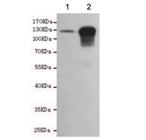 E-cadherin Antibody for WB in mouse embryo and human HCT116 cells. Western blot analysis of Cadherin 1 / CDH1 expression in 1) mouse embryo and 2) human HCT116 cell lysates using clone 6B10-F4-G10 antibody, showing bands near the predicted molecular weight of E-cadherin. E-cadherin is synthesized as a precursor and undergoes glycosylation, resulting in an apparent molecular weight typically observed between approximately 80-120 kDa, with the precursor form near 135 kDa. The detected bands are consistent with mature glycosylated E-cadherin, with stronger signal in HCT116 cells reflecting higher epithelial expression.
