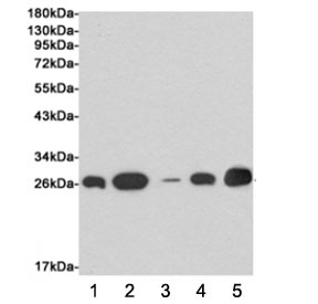 Western blot testing of human 1) MDA-MB-468, 2) ZR75-1, 3) MCF7, 4) T47D and 5) hamster CHO-K1 cell lysates using EIF4E antibody at 1:1000. Predicted molecular weight ~27 kDa.