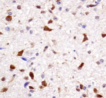 IHC testing of FFPE rat brain tissue with HOXA7 antibody.