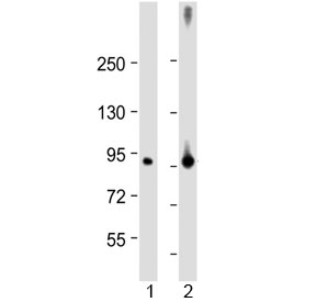 Western blot testing of human 1) lung and 2) placenta lysate with Factor XIIIa antibody rabbit polyclonal at 1:2000. Predicted molecular weight ~83 kDa.