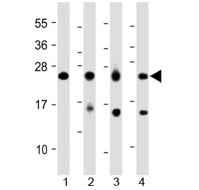 MYL1 Antibody Multi-Sample WB. Western blot analysis of human and rodent lysates using MYL1 antibody detecting Myosin light chain 1. Lane 1: human heart, Lane 2: human skeletal muscle, Lane 3: mouse skeletal muscle, Lane 4: rat skeletal muscle. A band is detected at approximately 20-22 kDa, consistent with the predicted molecular weight of MYL1. Stronger signal in skeletal muscle samples compared to heart tissue aligns with the preferential expression of MYL1 in fast skeletal muscle fibers, supporting its role as a contractile protein associated with myofibrillar structure.
