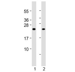 MYL1 Antibody Muscle WB. Western blot testing of 1) human skeletal muscle and 2) rat skeletal muscle lysate with MYL1 antibody at 1:2000. Predicted molecular weight ~21 kDa.