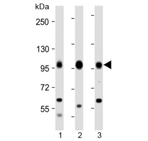 Western blot testing of human 1) Daudi, 2) Raji and 3) Jurkat cell lysate with MAP4K1 antibody at 1:2000. Predicted molecular weight ~91 kDa.