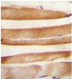 IHC staining of FFPE human skeletal muscle with ARV1 antibody. HIER: boil tissue sections in pH6, 10mM citrate buffer, for 20 min and allow to cool before testing.