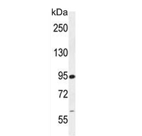 Western blot testing of human Jurkat lysate with RSBN1 antibody. Predicted molecular weight ~91 kDa.