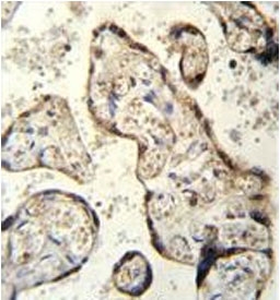 IHC testing of FFPE human placenta tissue with RSBN1 antibody. HIER: steam section in pH6 citrate buffer for 20 min and allow to cool prior to staining.
