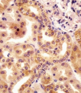 IHC testing of FFPE human kidney tissue with RSBN1 antibody. HIER: steam section in pH6 citrate buffer for 20 min and allow to cool prior to staining.