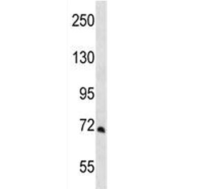 Western blot testing of human A549 cell lysate with PCCA antibody. Predicted molecular weight ~80 kDa.