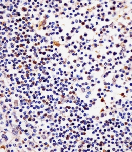 IHC testing of FFPE human tonsil tissue with TERT antibody. HIER: steam section in pH6 citrate buffer for 20 min and allow to cool prior to staining.