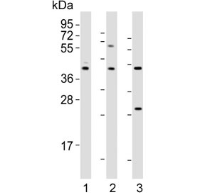 Western blot testing of human 1) brain, 2) K562 and 3) cerebellum lysate with DRD2 antibody. Predicted molecular weight ~51 kDa.