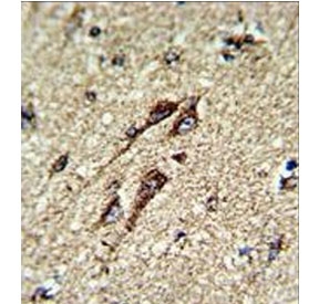 IHC testing of FFPE human brain tissue with ATP5B antibody. HIER: steam section in pH6 citrate buffer for 20 min and allow to cool prior to staining.