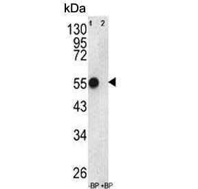 Western blot testing of human WiDr cell lysate in the absence and presence of immunizing peptide with ATP5B antibody. Predicted molecular weight ~56 kDa.