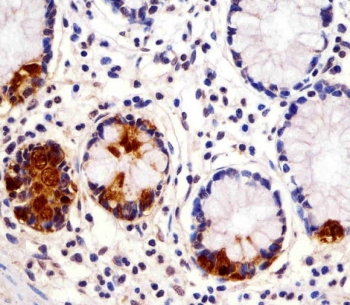 IHC testing of FFPE human small intestine tissue with REG3G antibody. HIER: steam section in pH6 citrate buffer for 20 min and allow to cool prior to staining.