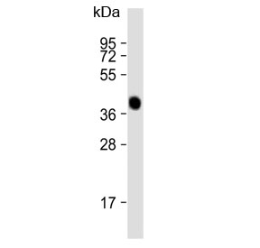 Western blot testing of human liver lysate with AGXT antibody. Predicted molecular weight ~43 kDa.