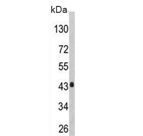 Western blot testing of human HepG2 cell lysate with AGXT antibody. Predicted molecular weight ~43 kDa.